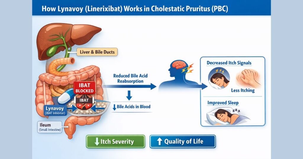 Lynavoy linerixibat IBAT inhibitor for cholestatic pruritus in primary biliary cholangitis mechanism and benefits